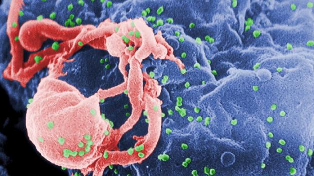 Sudafrica, fallito un test per un vaccino contro l'Hiv 