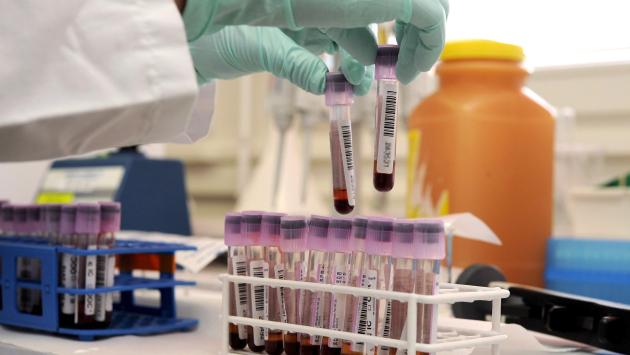 Epatiti acute nei bimbi, cresce l'allarme in Europa