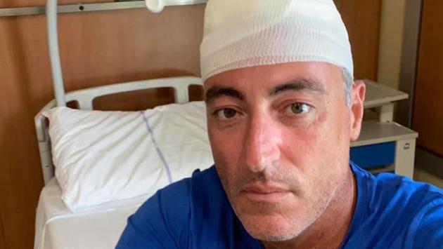 Lavagna, l'assessore Gallera sbatte la testa, 30 punti di sutura