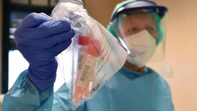 Covid: a Parma 5 nuovi casi (tre sintomatici). In Regione 65 persone positive in più