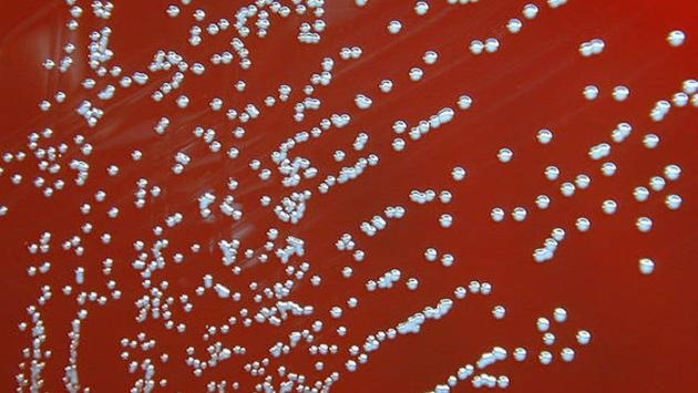 Cina: 3mila infettati da batterio fuggito da un laboratorio
