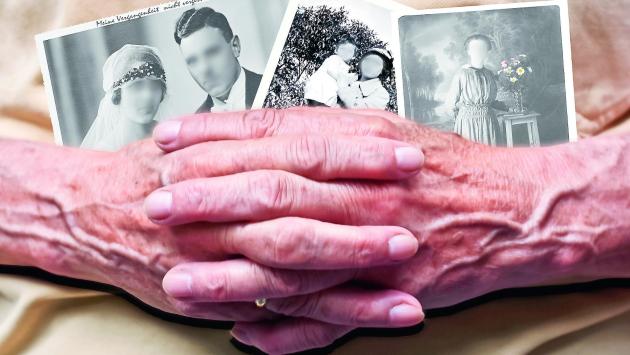 Demenza, proteine sangue svelano chi si ammalerà in 10 anni