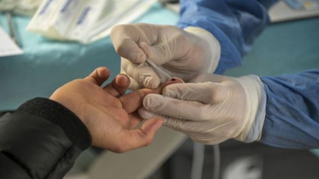 Covid, 20.648 nuovi casi e 541 vittime nelle ultime 24 ore