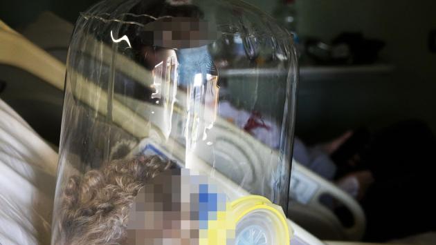 Pneumologie, i reparti resistono: «Ma il rischio terza ondata è elevato»