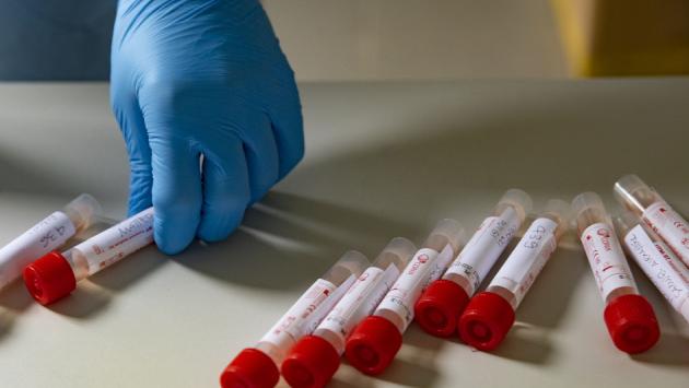 Aggiornamento informatico in ritardo: slitta la partenza dei tamponi a 15 euro