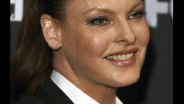 Linda Evangelista patteggia dopo disastro dal dermatologo
