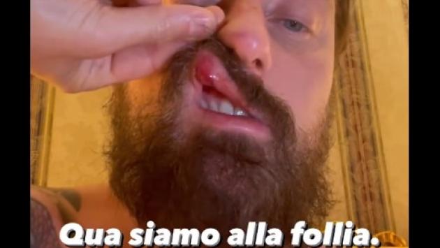Facchinetti, 'io aggredito senza ragione da McGregor'