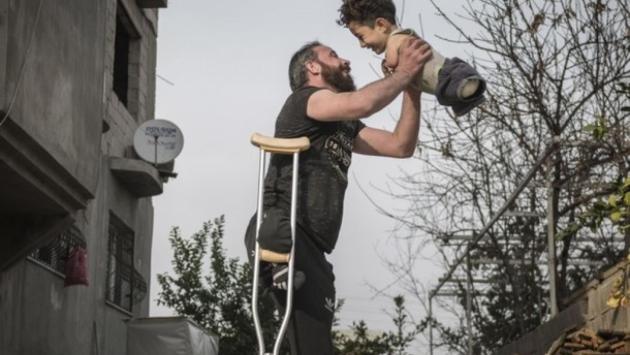 Bimbo e papà senza arti, la foto simbolo del dramma siriano 