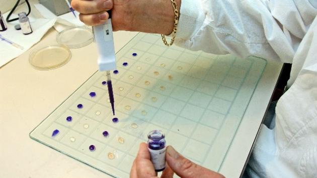 Gli anticorpi monoclonali evitano danni ai polmoni e al sistema nervoso