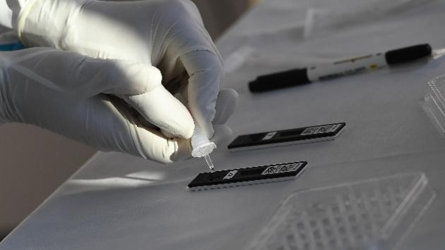 Parma, 26 nuovi positivi. Ma c'è un ricoverato in meno in terapia intensiva Covid