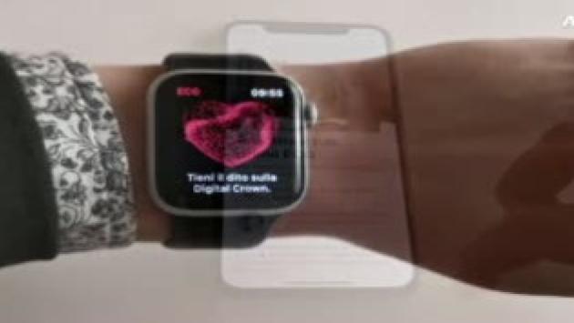 Su Apple Watch arriva l'elettrocardiogramma