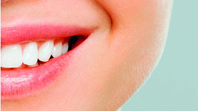 Denti bianchi