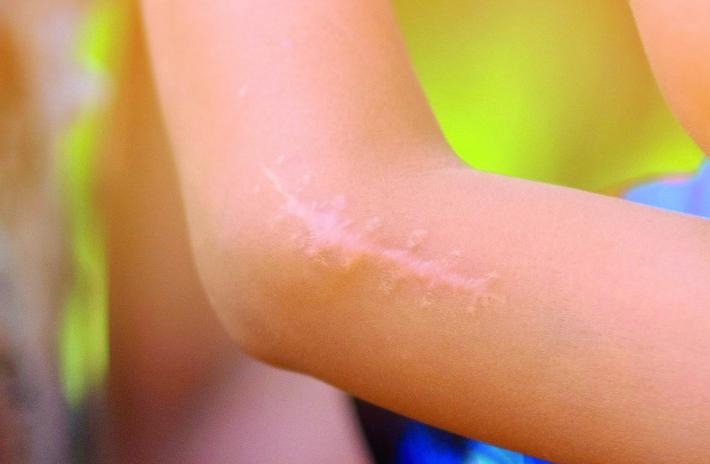 Cicatrici addio e i padri in sala parto