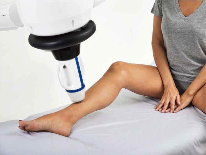 Vene varicose, trattarle con gli ultrasuoni