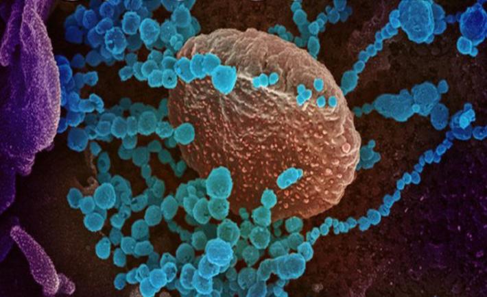 Coronavirus: a Parma 80 nuovi casi e due morti (due donne di 82 e 93 anni)