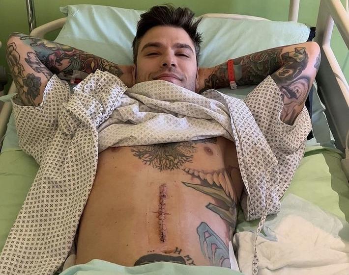 Fedez, scoperto raro tumore neuroendocrino del pancreas 