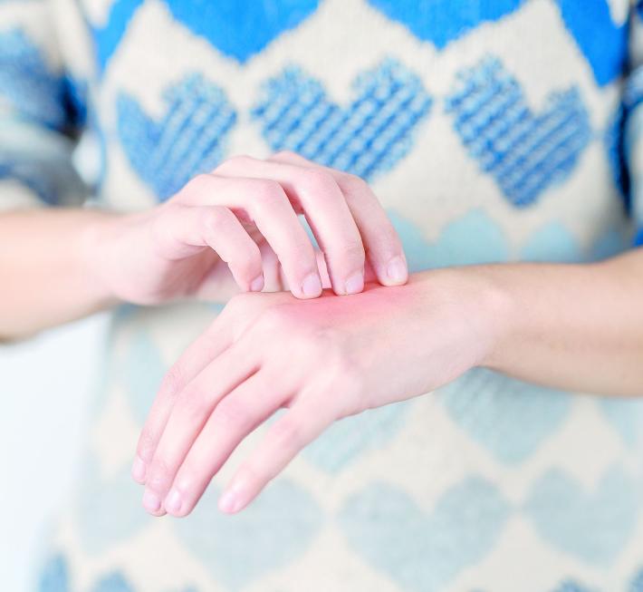 Punture d'insetti. Occhio ai rischi