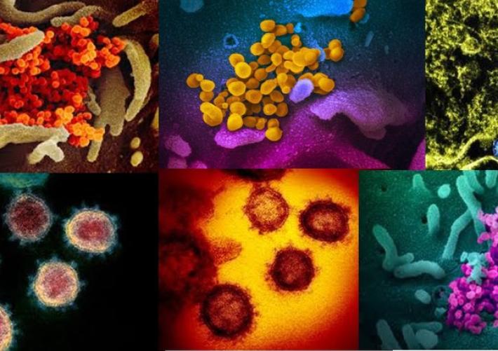 A Parma 5 decessi, il dato pi&ugrave; alto in Emilia. I nuovi contagi sono 193