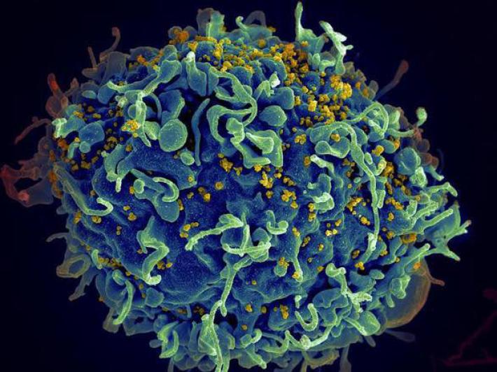 Via libera dell'Agenza del farmaco: sar&agrave; gratuita la pillola contro il contagio da Hiv