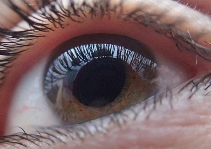 Bene test cornea artificiale, restituita vista a 14 pazienti