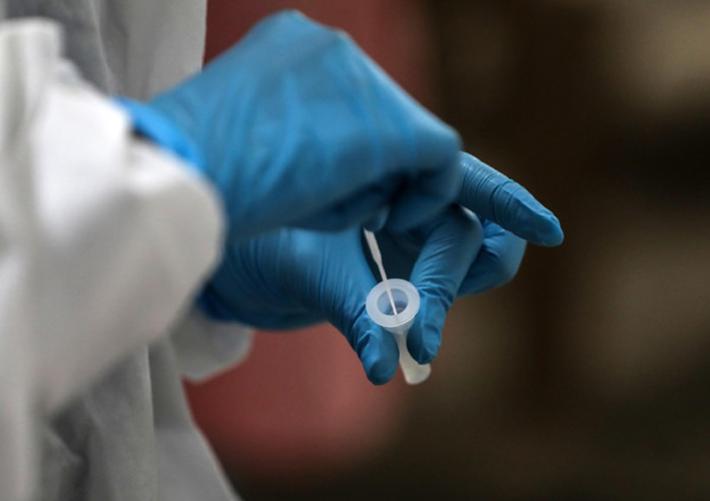 test covid coronavirus