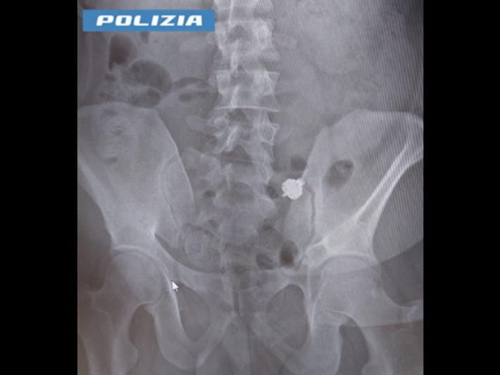 Patente, all'esame  con auricolari e smartphone nascosti: nei guai