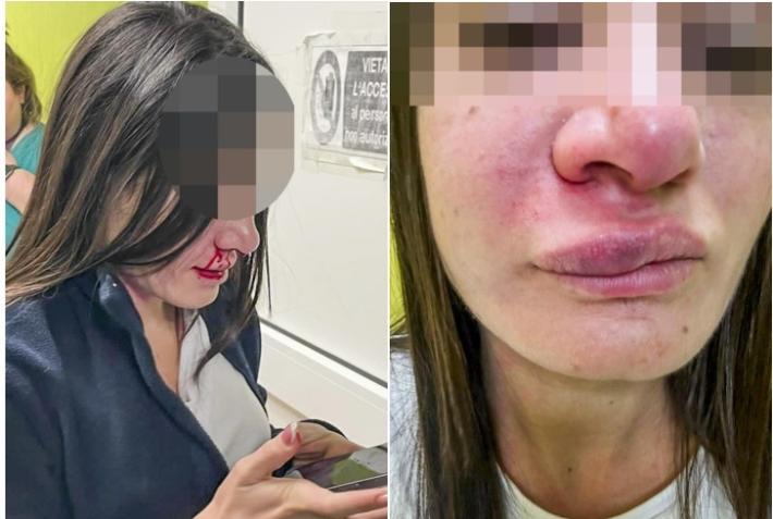 Infermiera trascinata per i capelli e colpita con pugno in viso