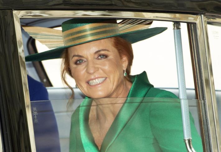 Sarah Ferguson ha un cancro alla pelle (dopo quello al seno)
