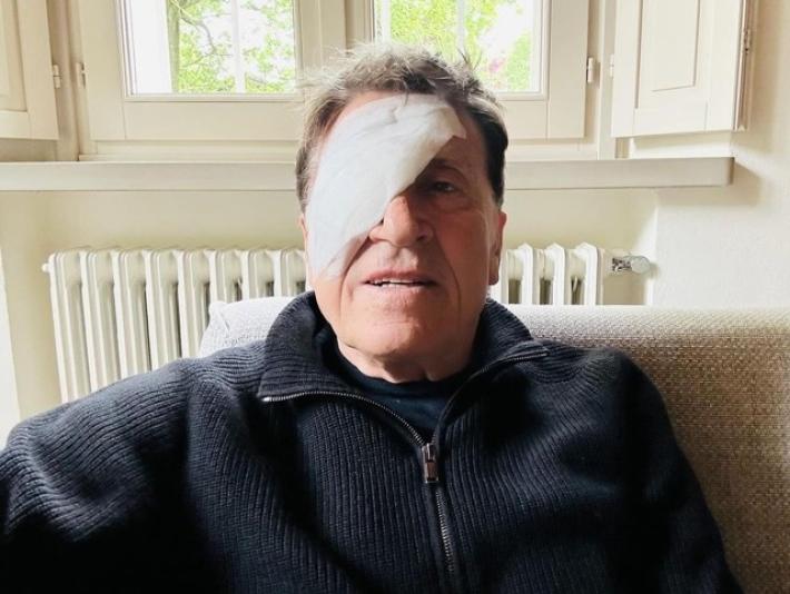 Gianni Morandi bendato su social scherza, 'ho fatto a pugni' 