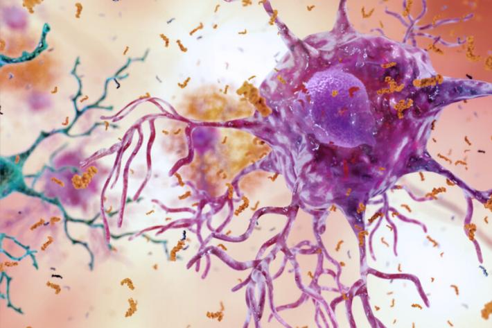 Alzheimer, speranze da uno spray nasale dopo test su animali