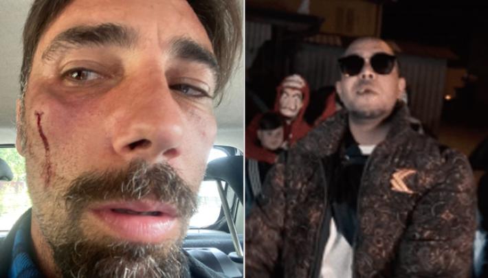 Diffam&ograve; Brumotti, condannato trapper