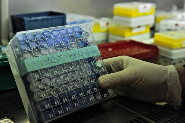 Donna muore a Pescara a causa di una meningite fulminante