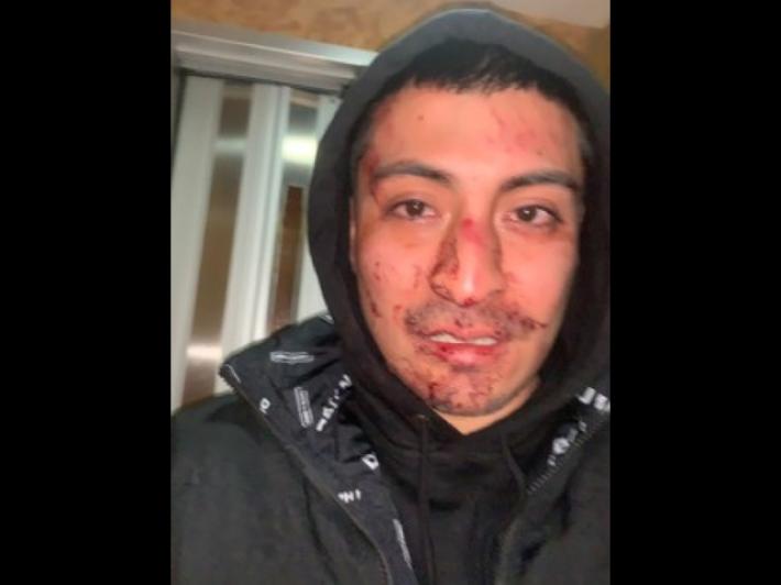 In 10 aggrediscono coppia gay con botte e insulti omofobi