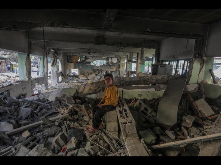 La Regione Emilia-Romagna: "Pronti ad accogliere il piccolo Adam da Gaza"