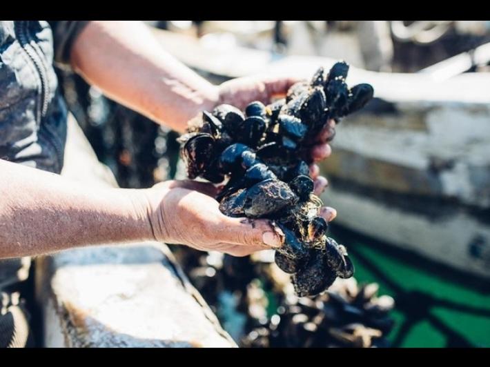 Al Cotugno di Napoli 60 ricoverati con l'epatite A, a marzo finora 89 casi