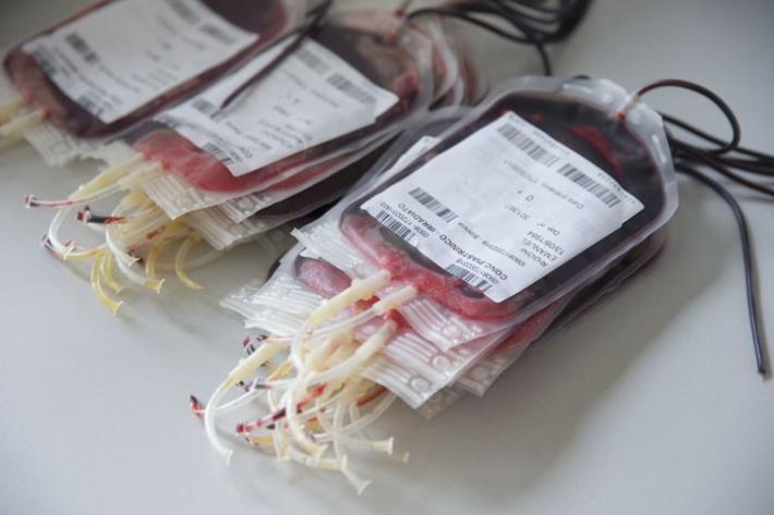 Nas, chiusi 52 centri: sangue manipolato per estetica 