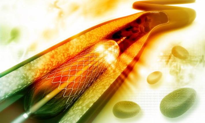 Compie 40 anni il palloncino &laquo;salva-vite&raquo;