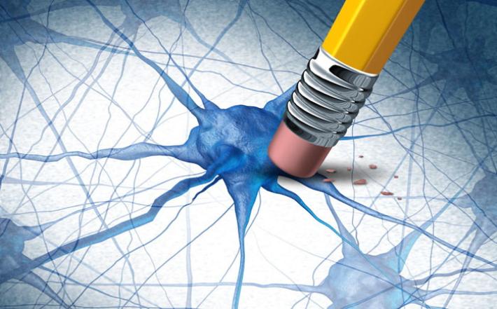 Parkinson, dall'immunoterapia una possibile svolta per le cure