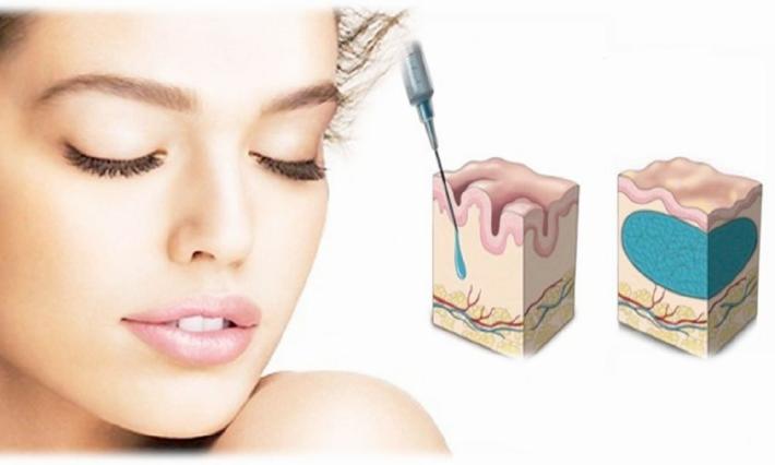 Ringiovanire il viso senza bisturi