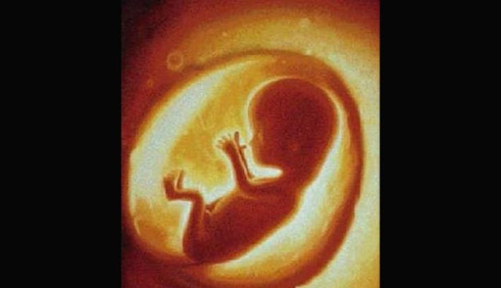 No al cesareo per mancanza di anestesisti: il bimbo muore