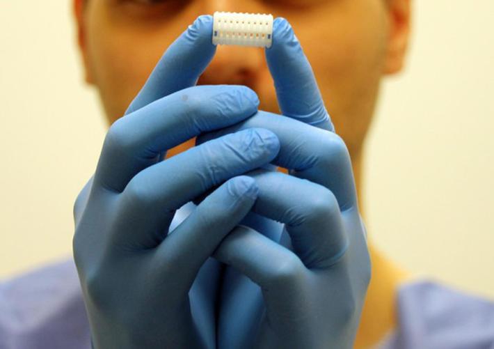 Bronco in 3D restituisce il respiro a un bimbo