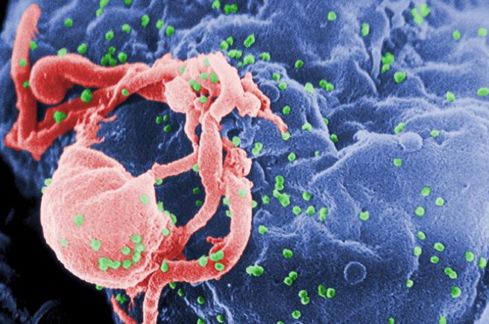 Veneto, contrae l'Hiv mentre prepara la tesi, denuncia gli Atenei