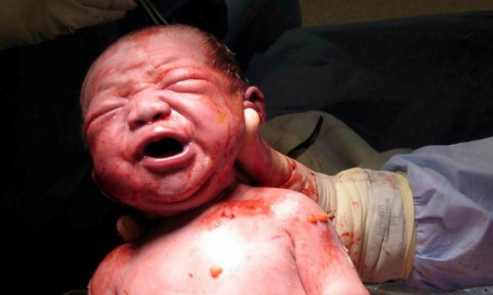 L'ecografia in sala parto, un aiuto per mamme e bimbi