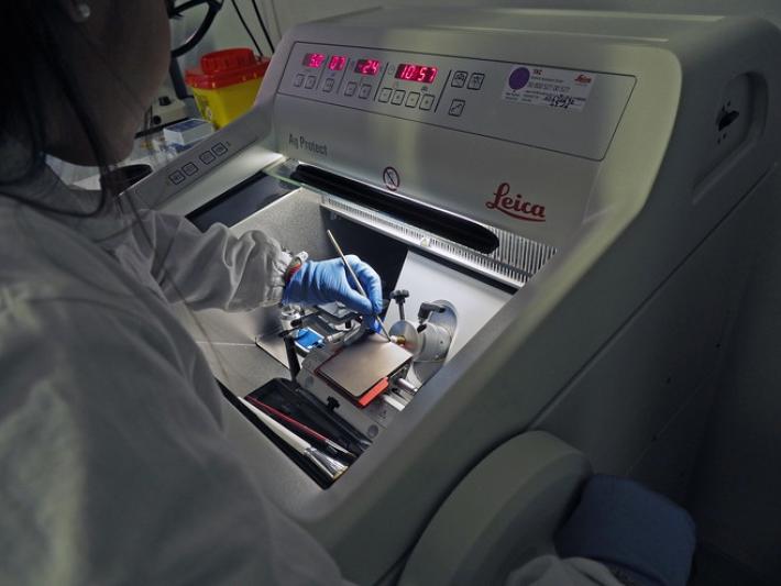 Trapianto renale, a Parma un nuovo strumento di  ricerca e diagnosi