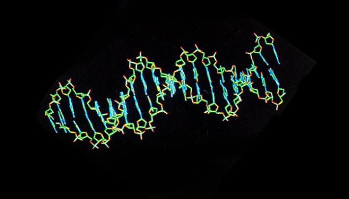 Sindrome di Down, un gene dietro alle malformazioni del cuore