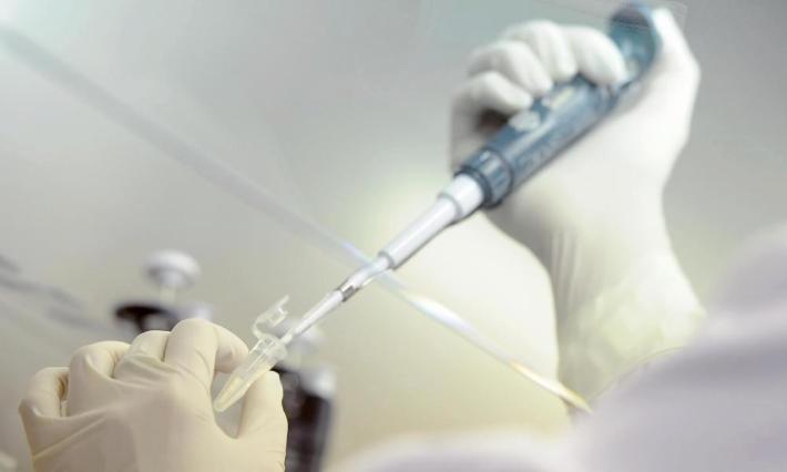 Vaiolo delle scimmie