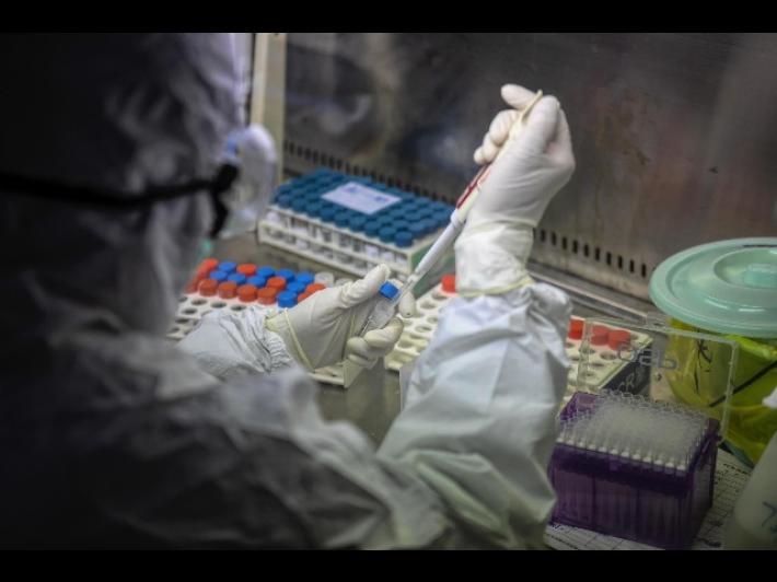 Oxford,  buoni risultati dalla sperimentazione del vaccino sui macachi