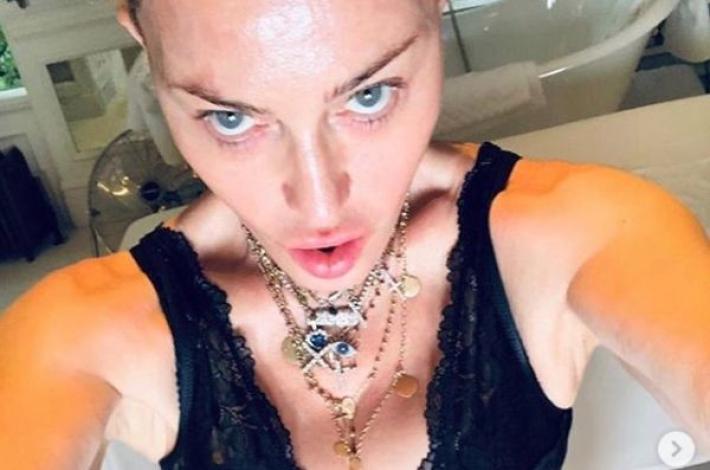 Madonna "mi sottoporro' a un intervento di medicina rigenerativa"