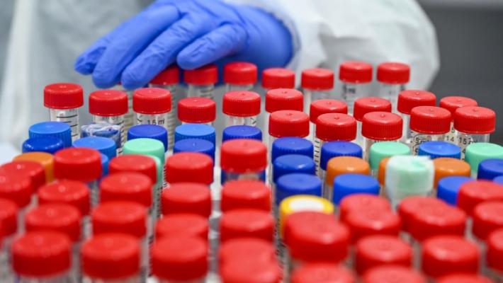 Emilia Romagna:  in calo infezioni da Hiv,  pi&ugrave;  che dimezzate da 2006