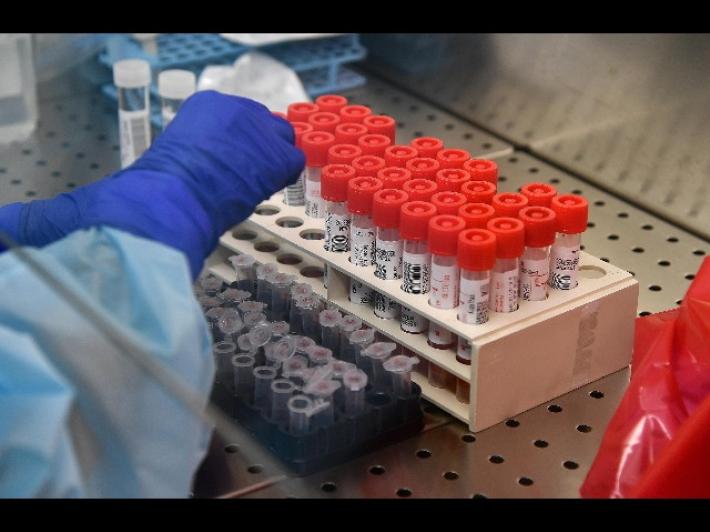 Domenica 14: 5 decessi in tutta l'Emilia Romagna, due sono a Parma (7 nuovi casi)